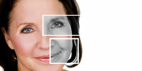 FALTENBEHANDLUNG MIT HYALURONSÄURE